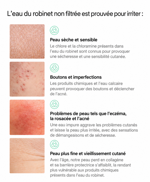 LE FILTRE À EAU — SKIN STANDARD