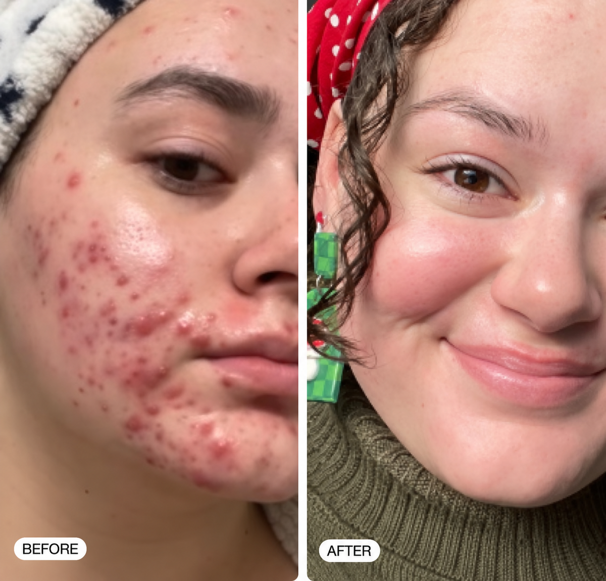 LE FILTRE À EAU — SKIN STANDARD